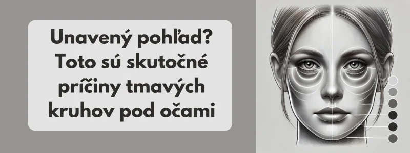 Tmave kruhy pod očami - obrázok pr článok
